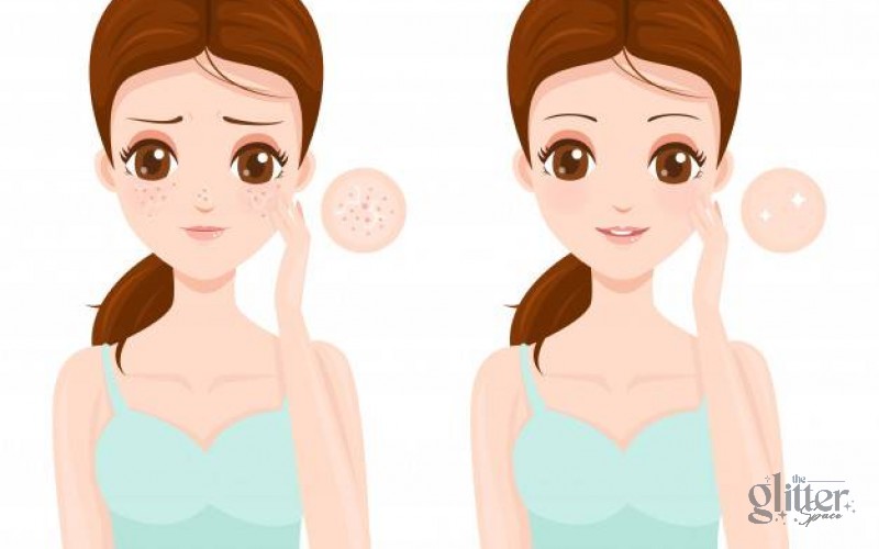 CÁCH LÀM SE KHÍT LỖ CHÂN LÔNG Ở MẶT NHANH CHÓNG VÀ HIỆU QUẢ CAO