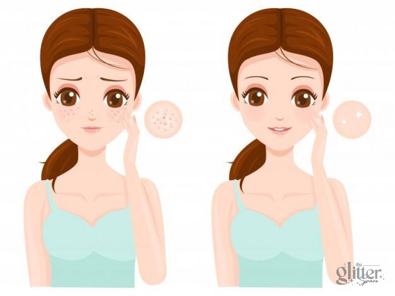 CÁCH LÀM SE KHÍT LỖ CHÂN LÔNG Ở MẶT NHANH CHÓNG VÀ HIỆU QUẢ CAO